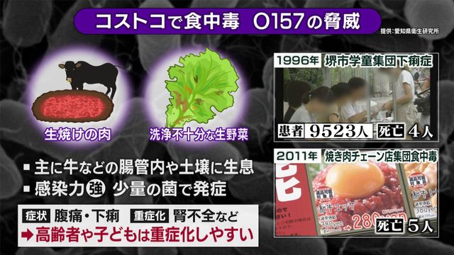 腸管出血性大腸菌「O157」の脅威　過去には死者や1万人近い大規模被害も　コストコ「ハイローラー」食中毒でも男児1人が重症に　改めて知るべき“今すぐできる”予防策