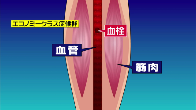 ショッピングモールで「車中泊の訓練」実施　プライバシーは守れるけれど…エコノミークラス症候群のリスク潜む　過去には死亡例も