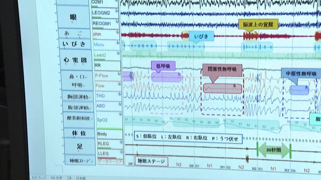 “最近よく眠れていますか？”　AIで“睡眠の質”改善も　診療科名に「睡眠障害」