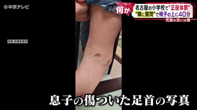 名古屋の小学校で“正座体罰” “隣に質問”で椅子の上に40分 児童の足には傷